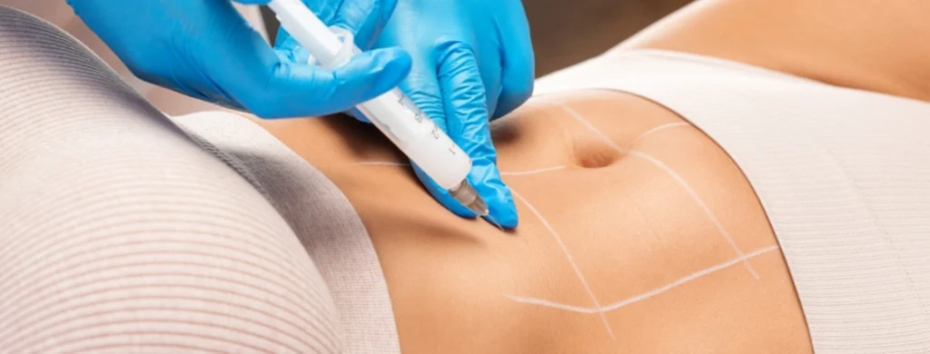 implante liofilizado de placenta